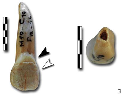 détails d'une dent partiellement digérée. Crédit photo : laboratoire PACEA