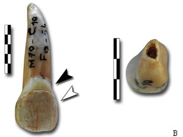 Nouveau challenge pour l'identification de dents humaines néandertaliennes