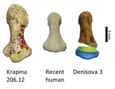 Comparaison des phalanges de Dénisova avec un Homme moderne et un Néandertalien (Eva-Maria Geigl)