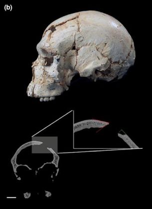 Examples of the forensic-taphonomic techniques applied for the breakage analysis of Sima de los Huesos hominin fossils:  Cranium 17 (Cr-17) perimortem trauma on the frontal squama (modified from Sala et al.)
